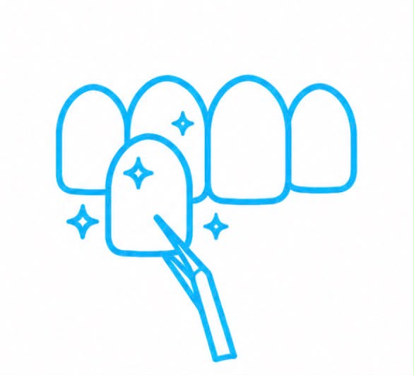 Diseños de Sonrisa 
