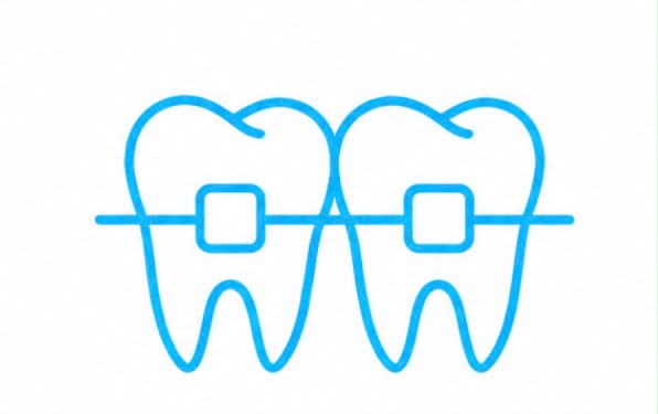 Ortodoncia con Brackets 